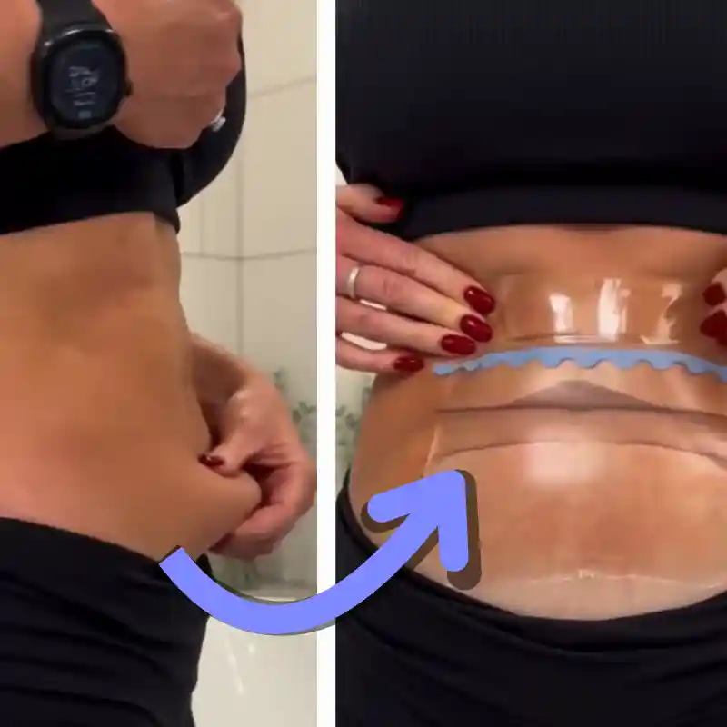 Före och efter applicering av Shape Tapes lyfttejp